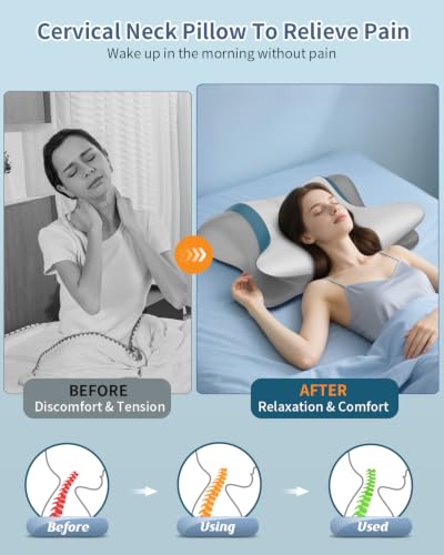 Beslovo Grey Cervical Pillow for Neck Pain Relief - Ergonomic Memory Foam Support for Side, Back & Stomach Sleepers