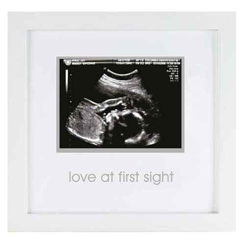 Pearhead Love at First Sight Sonogram Picture Frame, Gender Neutral Ultrasound Keepsake, Ideal Pregnancy Gift, Baby Shower and Nursery Decor, 4¡±x3¡± Photo Insert, White