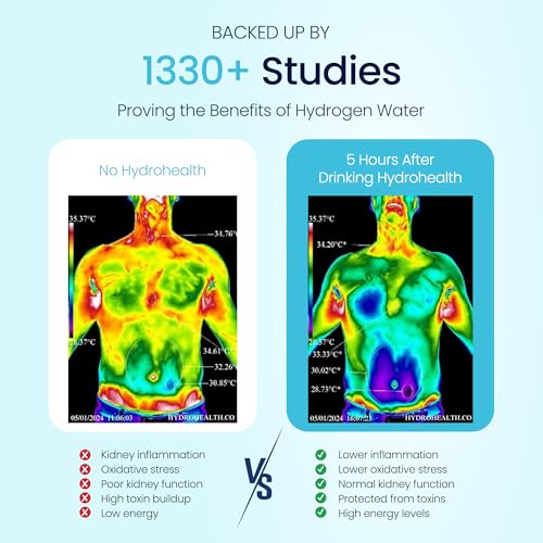 Hydrohealth Hydrogen Water Bottle for Kidney, Liver & Gut Health, 1600PPB, Rechargeable & Portable