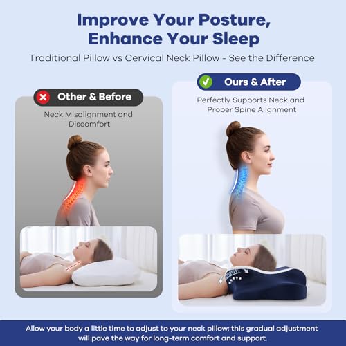 Ergonomic Cervical Pillow for Neck Pain - Memory Foam Contour Support