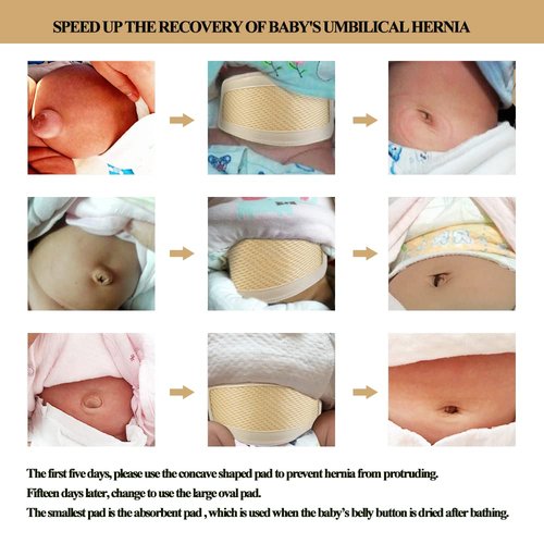 BOJEE Umbilical Hernia Belt Baby Belly Button Band Infant Belly Wrap Truss Abdominal Binder for Children Kids Support Adjustable Navel Belly Band Newborn Umbilical Cord 15-20 inch
