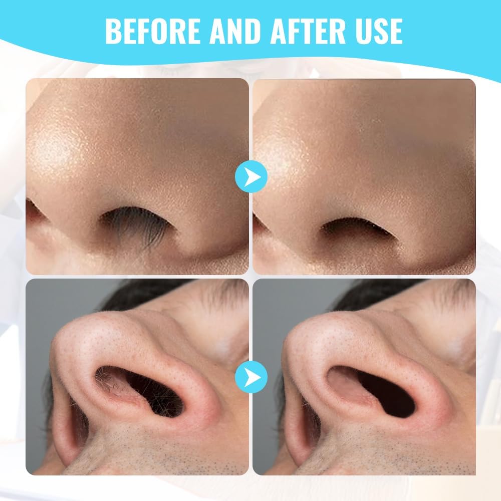 Skiennix Nasal Hair Cutter - 360° Rotating Nose Hair Trimmer with Ear Picker | Travel Essentials (Beige, 3 Packs)