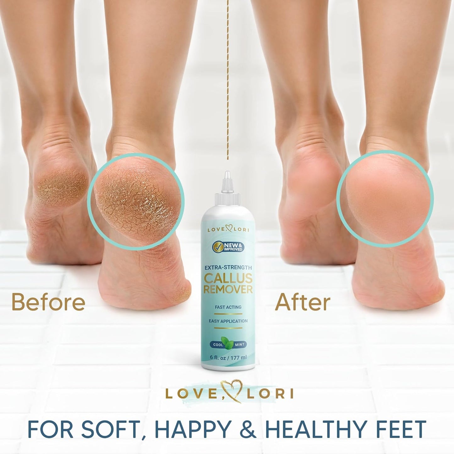 Regine Switzerland Callus Remover Gel - Extra Strength Foot Care Scrubber, 6oz for Smooth Feet