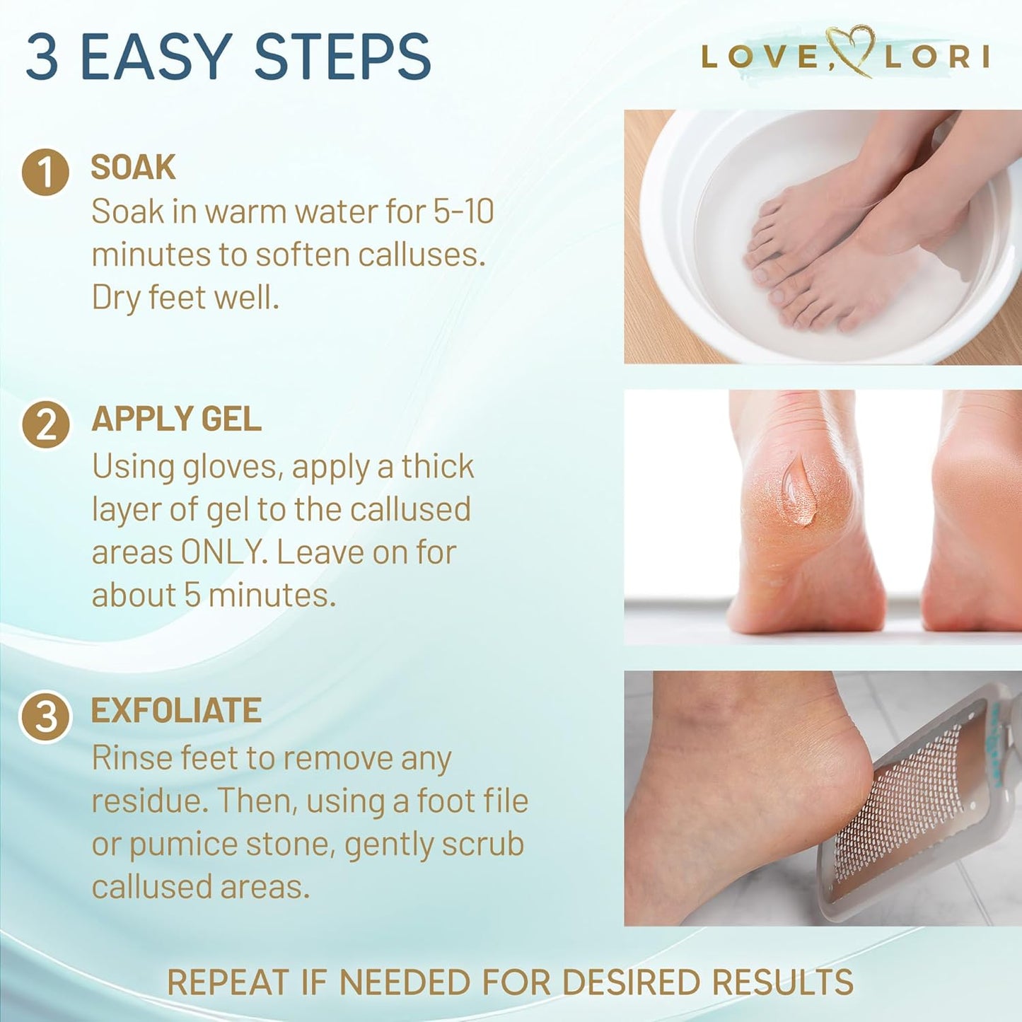 Regine Switzerland Callus Remover Gel - Extra Strength Foot Care Scrubber, 6oz for Smooth Feet