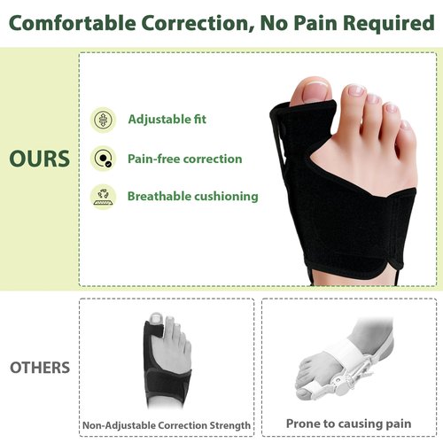 GIMCALO Bunion Corrector for Women & Men (2PCS), Adjustable Big Toe Separator, Day/Night Orthopedic Bunion Splint, Non-Surgical Hallux Valgus & Hammer Toe Straightener