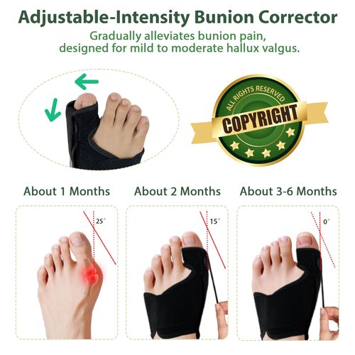 GIMCALO Bunion Corrector for Women & Men (2PCS), Adjustable Big Toe Separator, Day/Night Orthopedic Bunion Splint, Non-Surgical Hallux Valgus & Hammer Toe Straightener