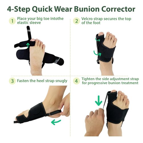 GIMCALO Bunion Corrector for Women & Men (2PCS), Adjustable Big Toe Separator, Day/Night Orthopedic Bunion Splint, Non-Surgical Hallux Valgus & Hammer Toe Straightener